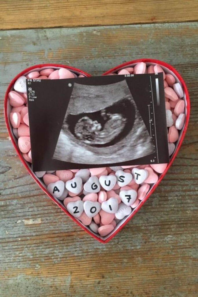 candy heart and ultrasound announcement