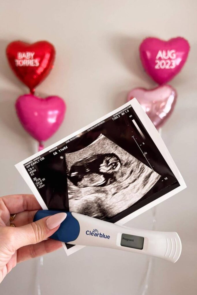 ultrasound photo pregnancy test and balloons