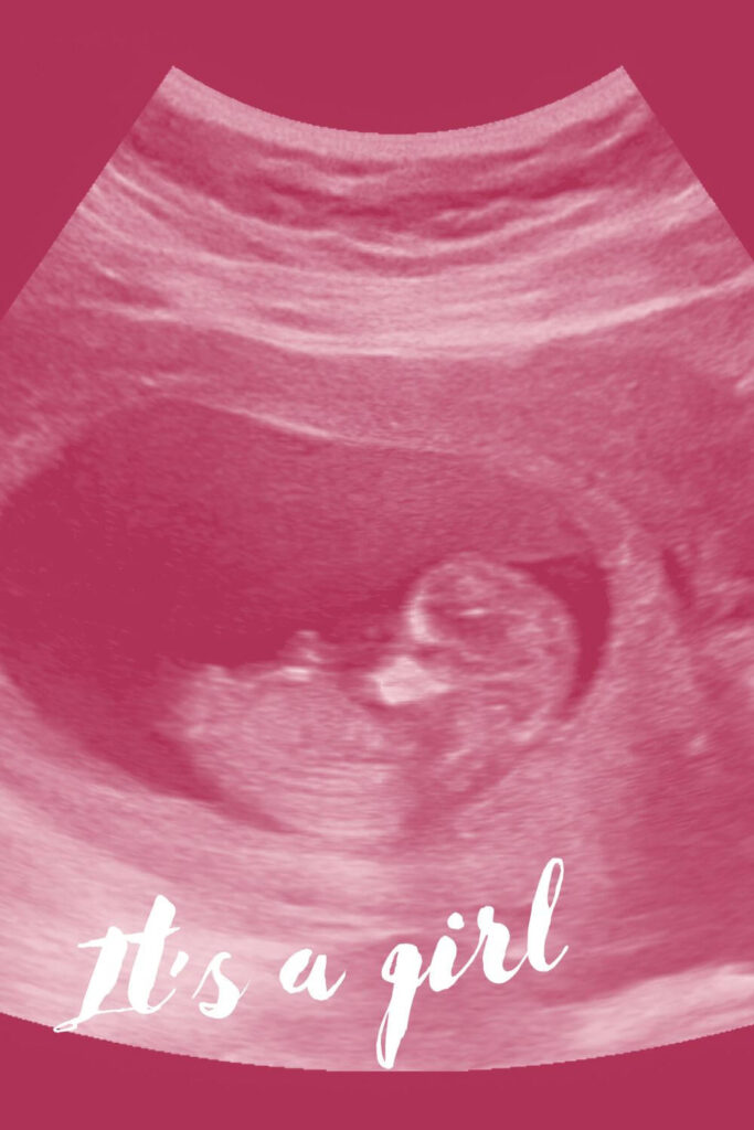 Social Media Filtered Ultrasound