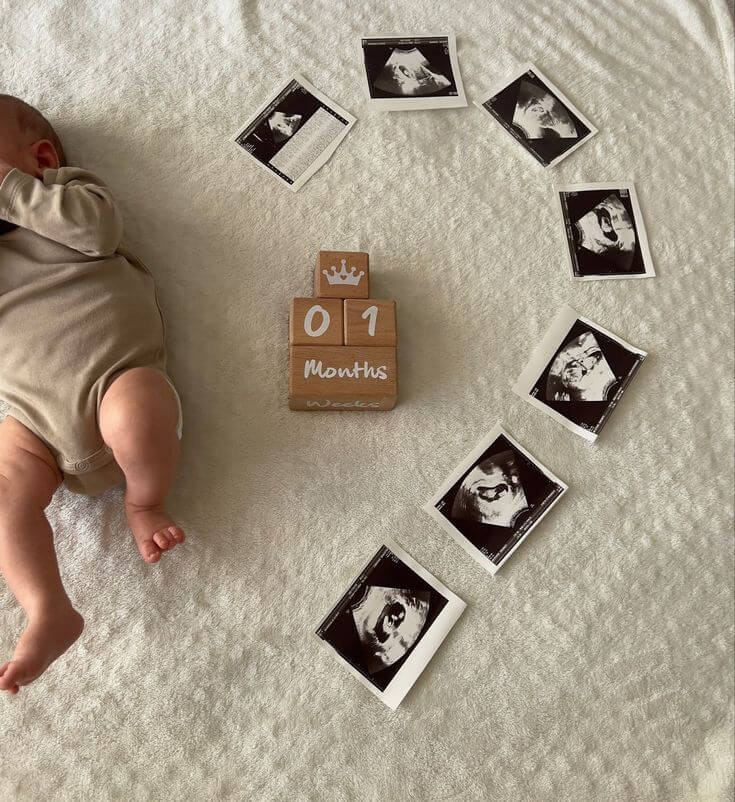 Ultrasound to Reality